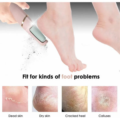 Esfoliante Elétrico de Pés com Tecnologia Derma Vac